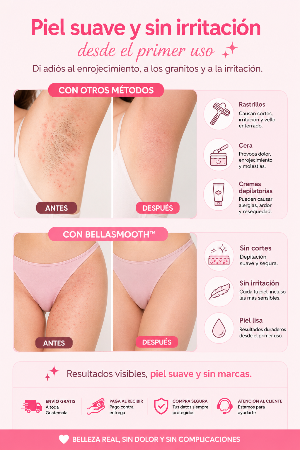 BellaSmooth™ | Depiladora Eléctrica 4 en 1 para Rostro y Cuerpo