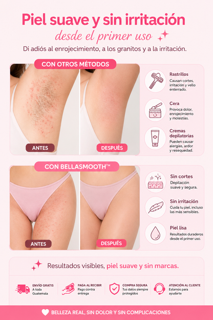 BellaSmooth™ | Depiladora Eléctrica 4 en 1 para Rostro y Cuerpo