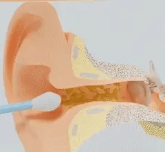 Visual EarCam Pro™ — Limpiador de Oídos con Cámara HD